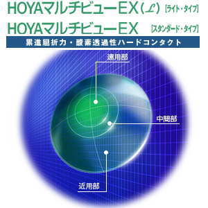 HOYAマルチビューEXライト